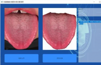 基于深度学习的面向中医诊断的舌象图像分割系统。它包含了多个程