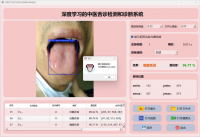 中医舌诊PyQt5检测系统