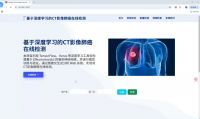 206-深度学习CT肺癌诊断系统