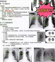 【0.01￥秒发】【医学影像学手写笔记】