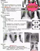 【医学影像学手写笔记】